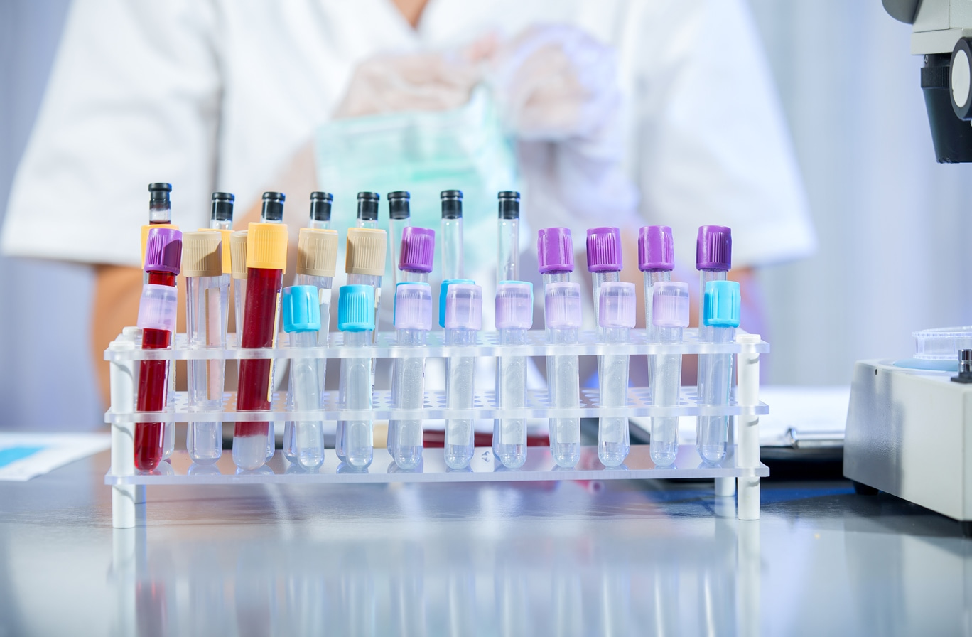 A test tube rack showing a number of samples.